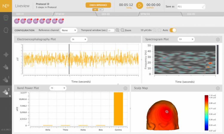 5def5d87dccbc.png NE Enobio3.png