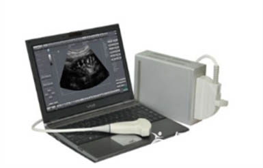 5def5f83765da.jpg Echo B.jpg