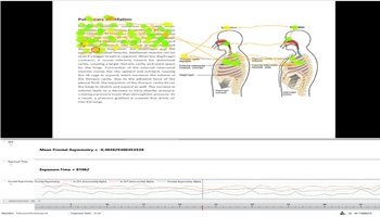 5df35c4c32bea.png image.png