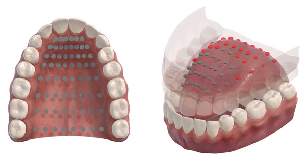 6190c9661ed0b.jpg how-3D-electropalatography-works.jpg